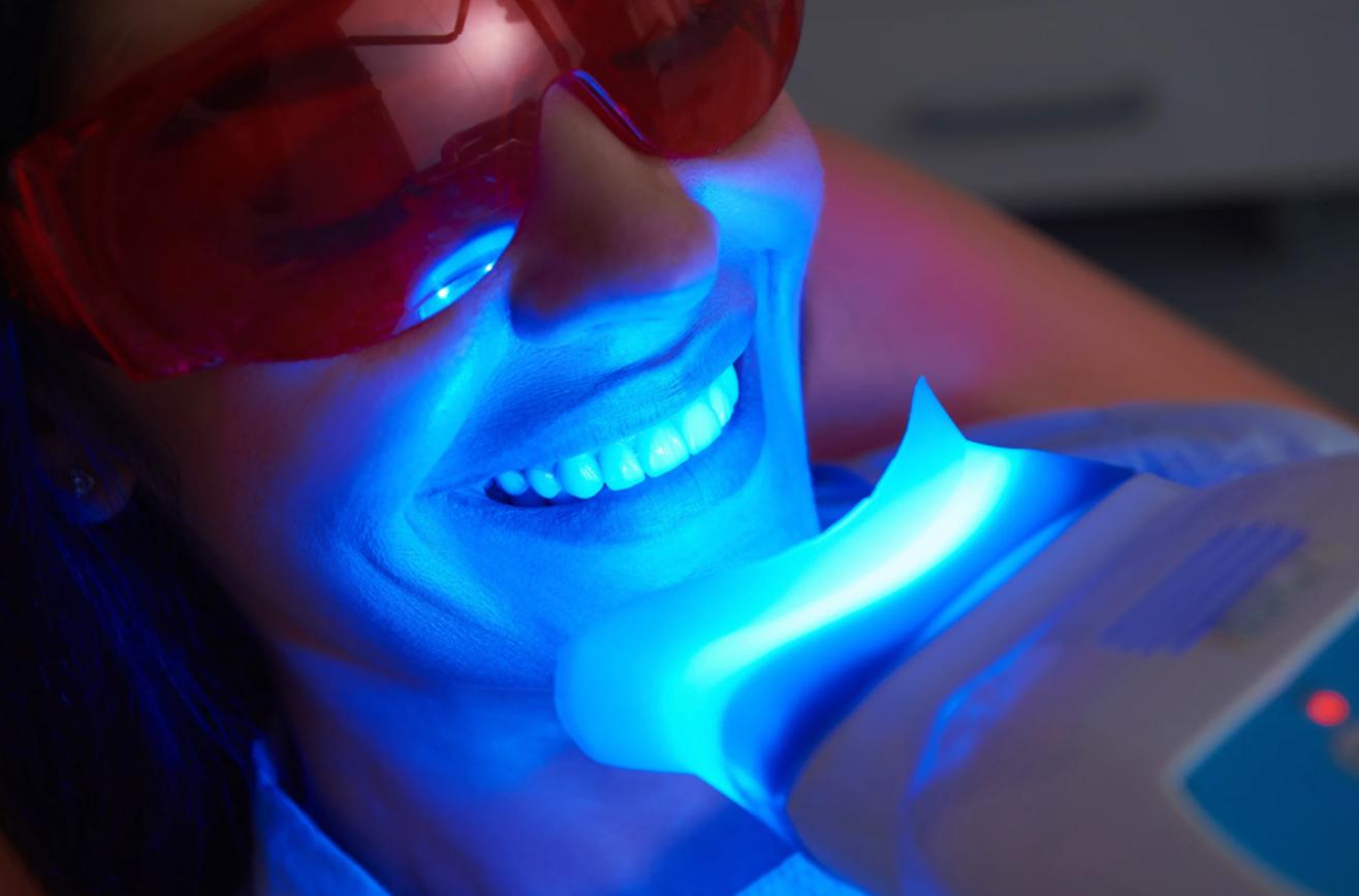 Nuyu Teeth Whitening Service for brighter, whiter teeth. Services performed in Essex Junction, VT